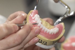 Изготовление съемного зубного протеза в Подольске - фото