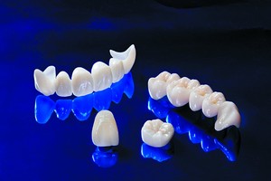 Несъемное протезирование зубов - фото